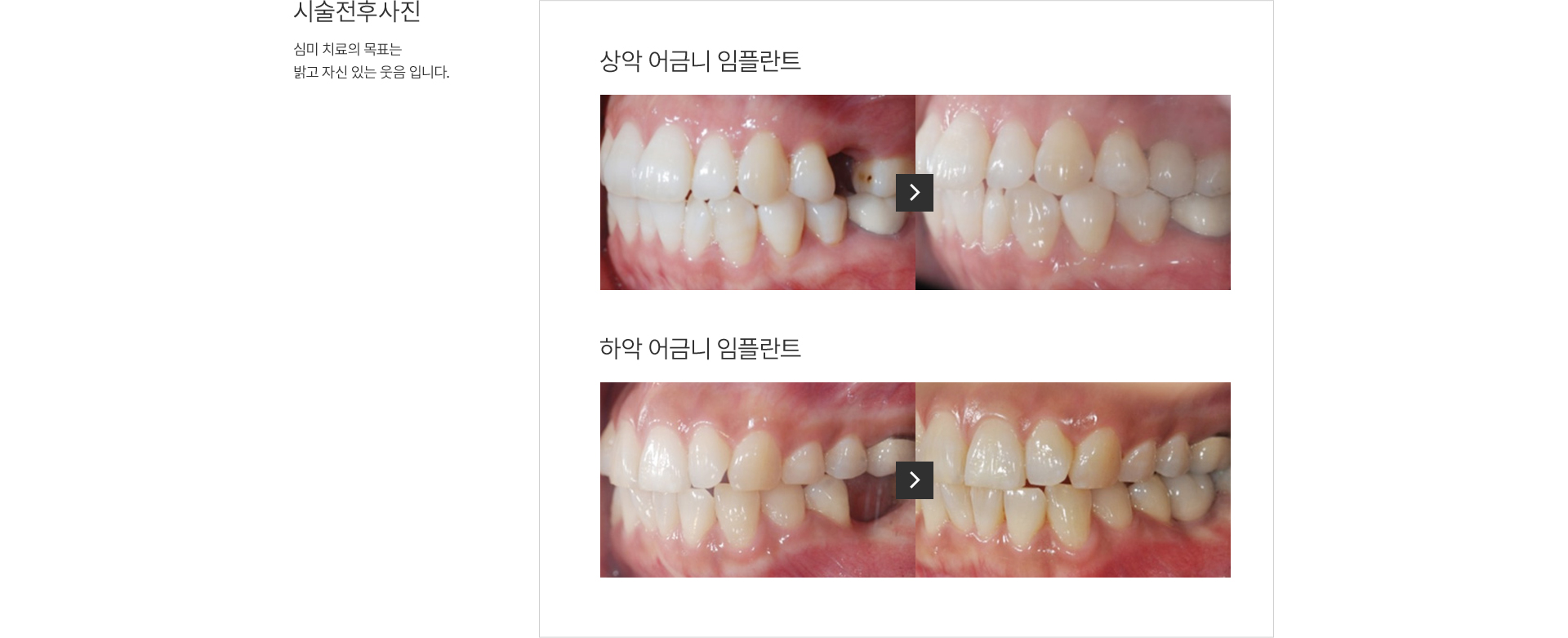 ���̻츮��