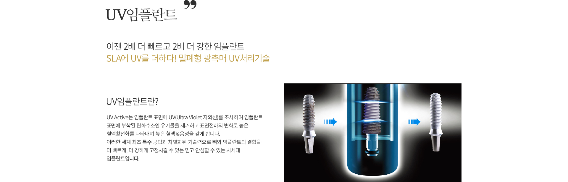 UV���ö�Ʈ