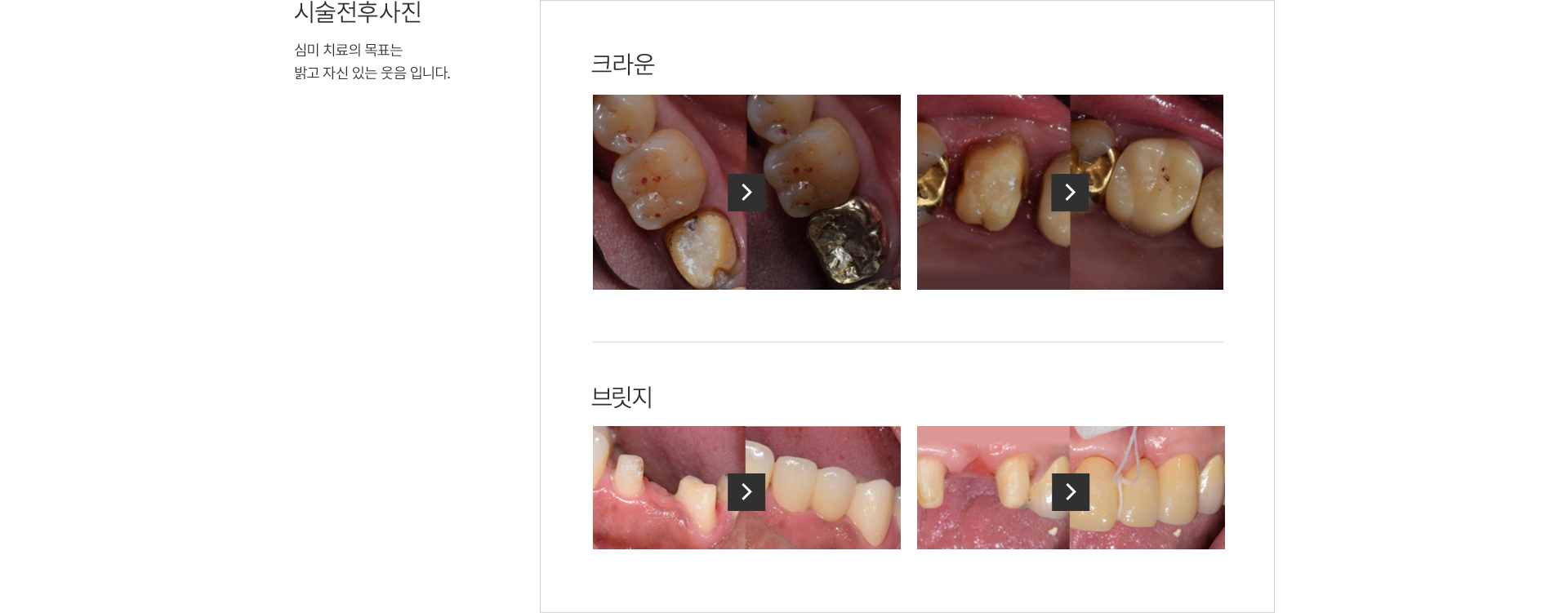ũ���,�긴��